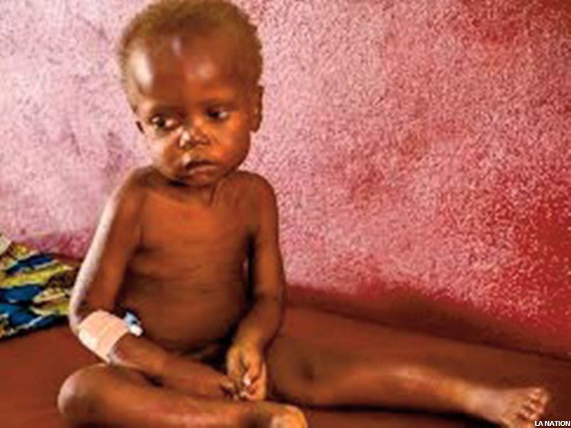 Âllo docteur ! La malnutrition (Deuxième partie)