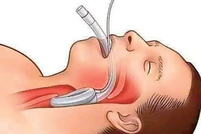 LU SUR UN MUR COVID-19 : Danger !